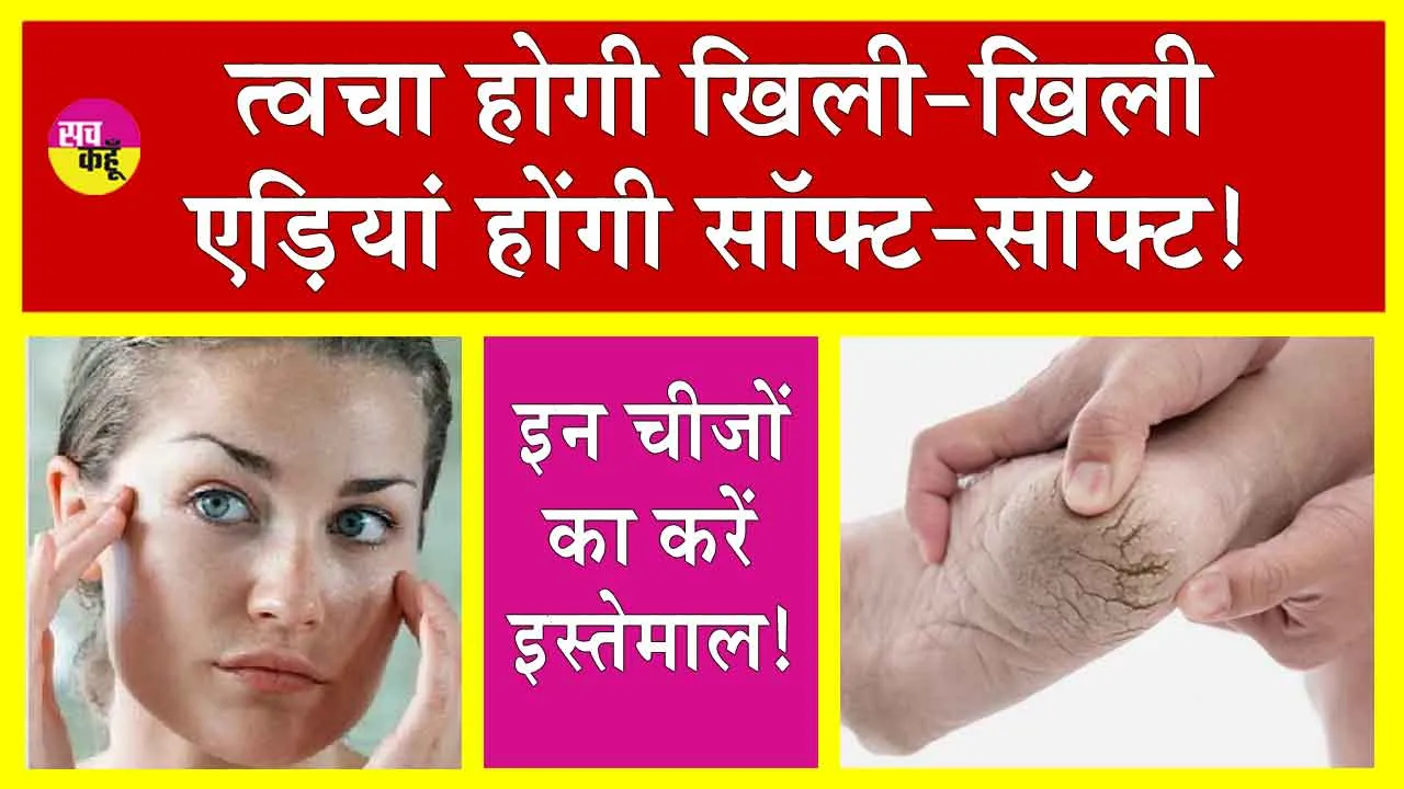 Skin Care Remedies: सर्दियों में त्वचा व फटी एड़ियों से हैं परेशान तो समाधान है आसान!