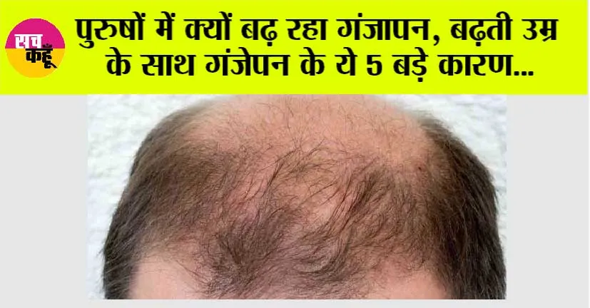 Hair Loss: पुरुषों में क्यों बढ़ रहा गंजापन, बढ़ती उम्र के साथ गंजेपन के ये 5 बड़े कारण