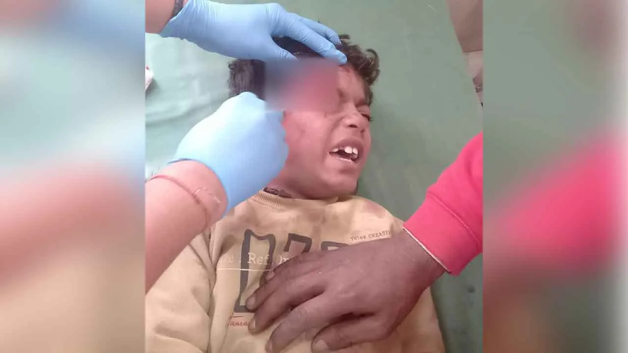 घर में घुसकर बालक पर जानलेवा हमले का आरोप