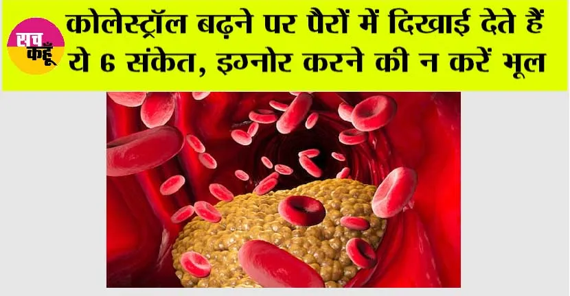 Cholesterol Symptoms: कोलेस्ट्रॉल बढ़ने पर पैरों में दिखाई देते हैं ये 6 संकेत, इग्नोर करने की न करें भूल