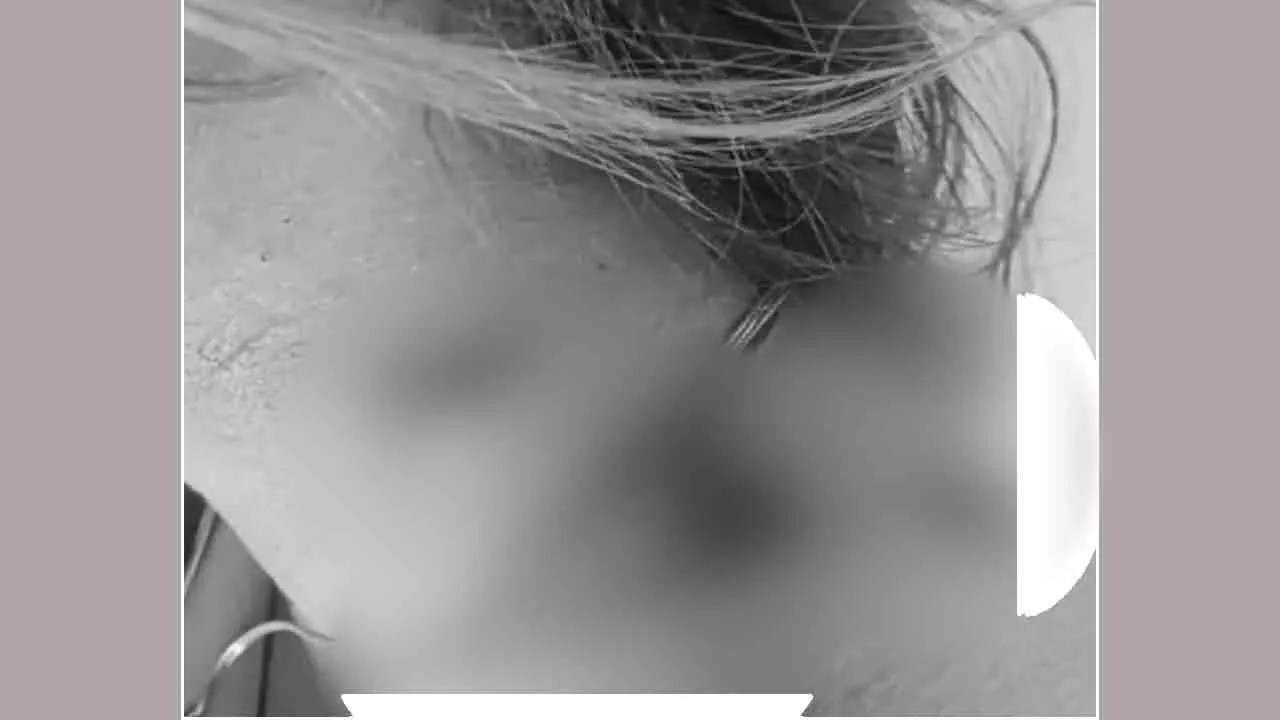 Beauty Parlour Firing: ब्यूटी पार्लर संचालिका पर चलाई गोली, कंधे और गर्दन को छूकर निकल गई गोली