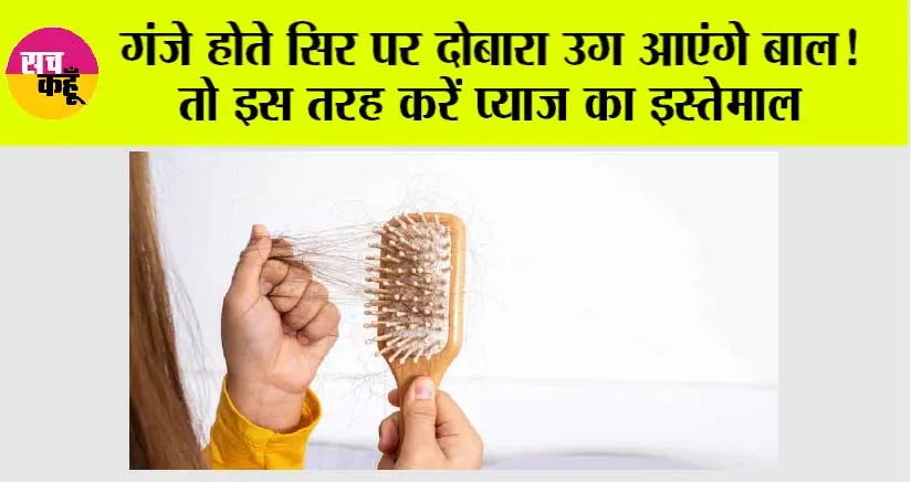 Hair fall Remedies: गंजे होते सिर पर दोबारा उग आएंगे बाल! बस इस तरह करें प्याज का इस्तेमाल