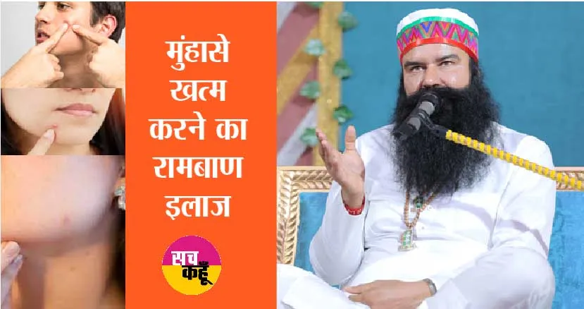 Acne Treatment: चेहरे पर मुंहासे का सबसे अच्छा इलाज | Ram Rahim Tips
