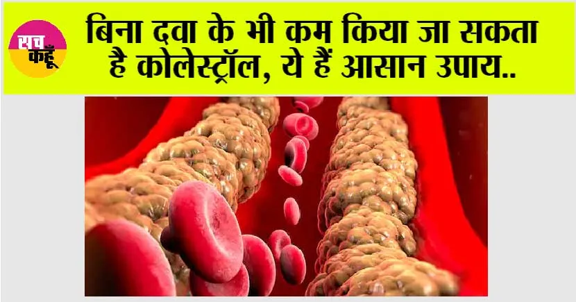 Cholesterol Level: बिना दवा के भी कम किया जा सकता है कोलेस्ट्रॉल, ये हैं आसान उपाय..
