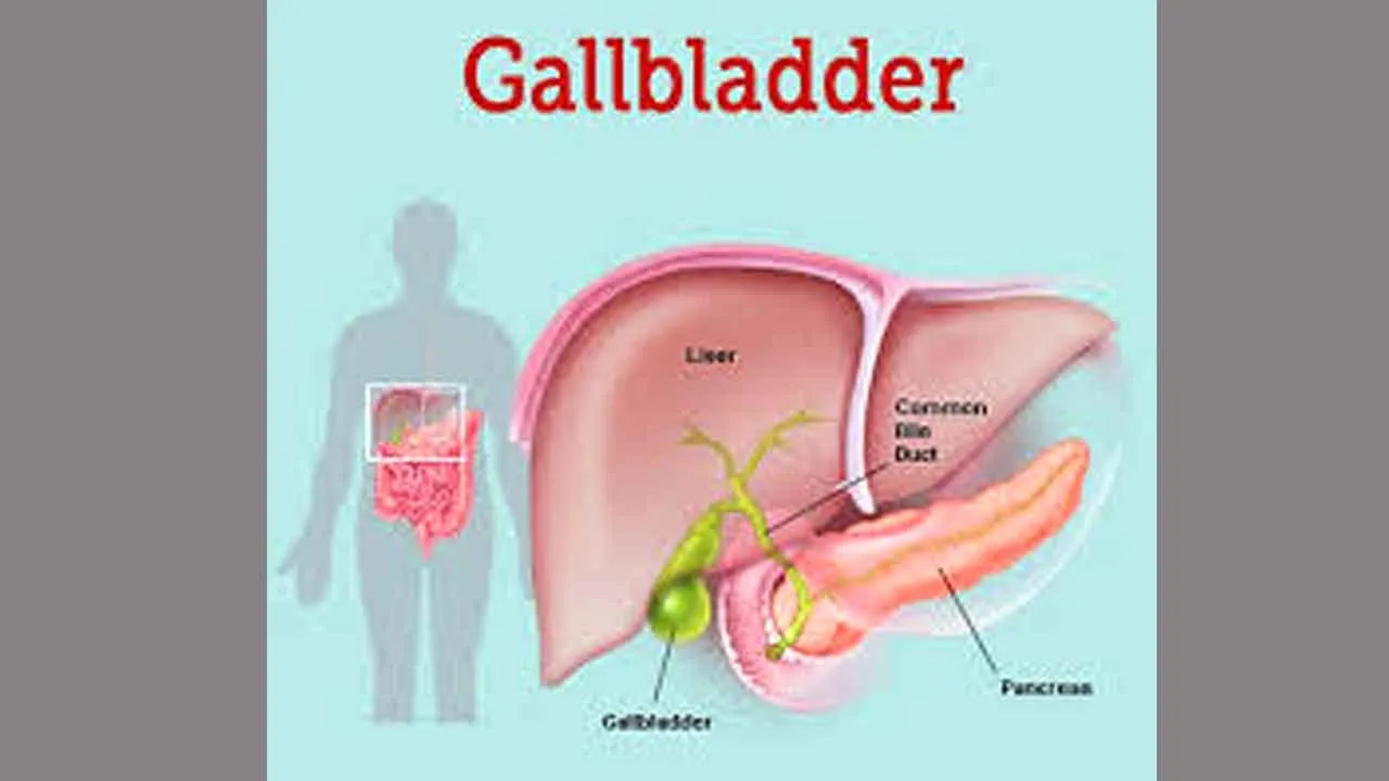 Gallbladder: गुरुग्राम में डॉक्टर्स ने 70 साल के बुजुर्ग के गॉलब्लैडर से निकाली 8125 पथरी