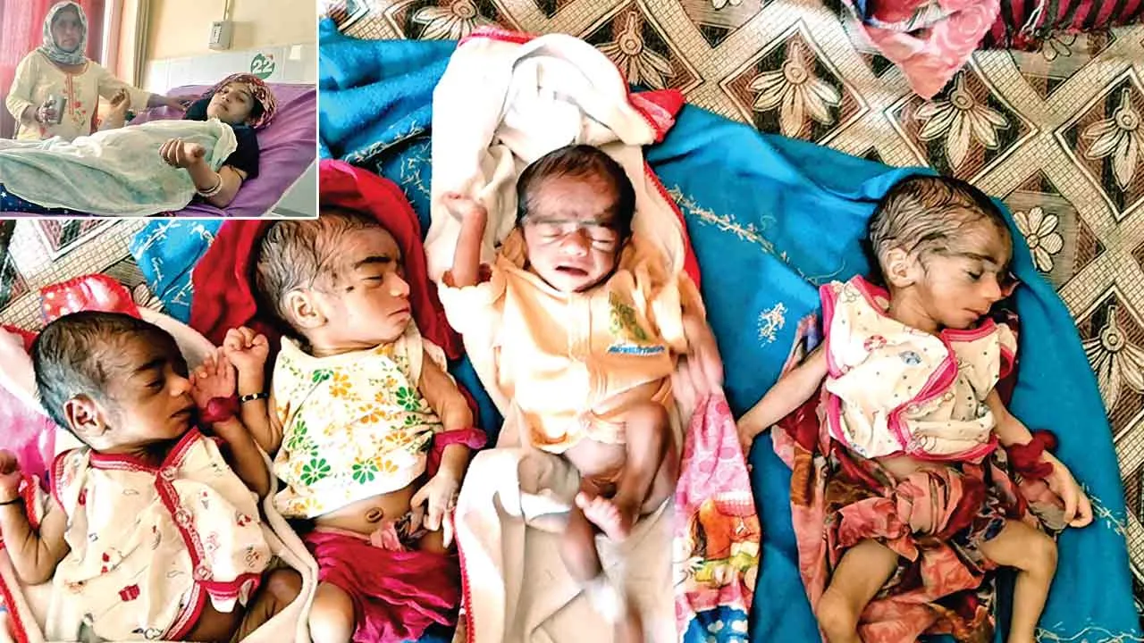 सरसा में महिला ने एक साथ दिया 4 बच्चों को जन्म