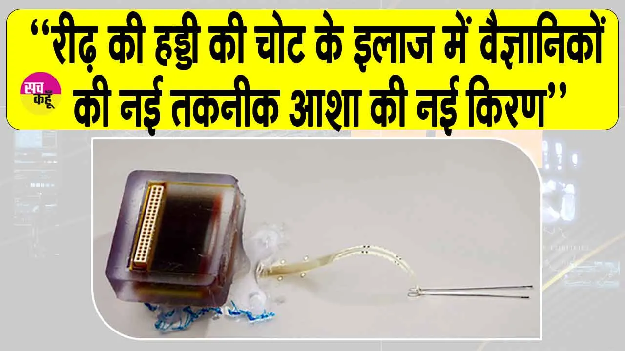 Spinal cord injury treatment: अब रीढ़ की हड्डी में गंभीर चोट के बाद भी रहें बेफिक्र!