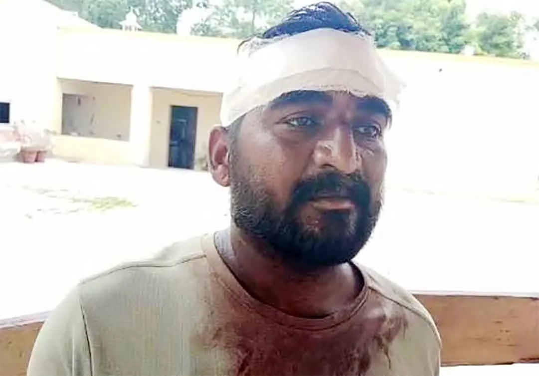 नगर परिषद के सफाई कर्मचारी पर हमला कर मारी चोटें