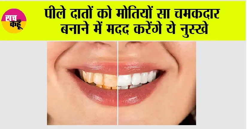 Teeth Cleaning Remedies: पीले दातों को मोतियों सा चमकदार बनाने में मदद करेंगे ये नुस्खे