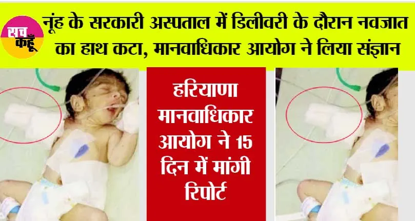 नूंह के सरकारी अस्पताल में डिलीवरी के दौरान नवजात का हाथ कटा, मानवाधिकार आयोग ने लिया संज्ञान