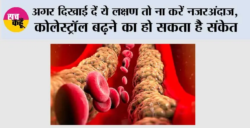 High Cholesterol Signs: दिखाई दें ये लक्षण तो ना करें नजरअंदाज, कोलेस्ट्रॉल बढ़ने का हो सकता है संकेत