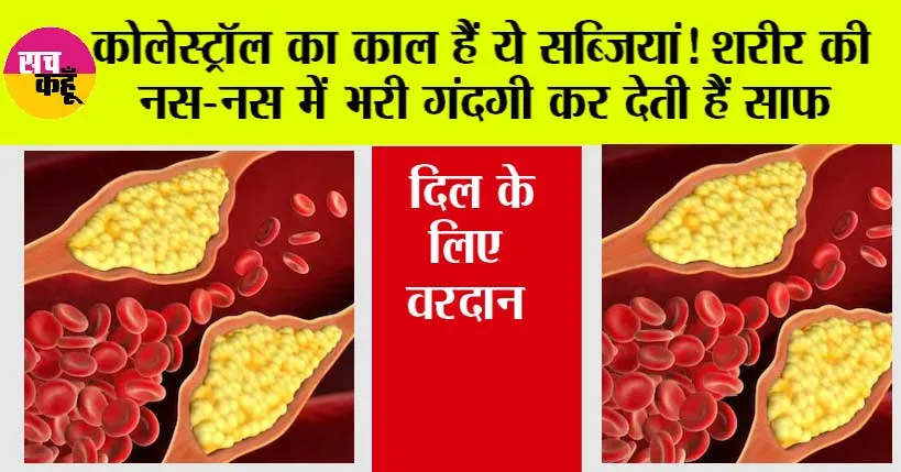 High Cholesterol: कोलेस्ट्रॉल का काल हैं ये सब्जियां! शरीर की नस-नस में भरी गंदगी कर देती हैं साफ