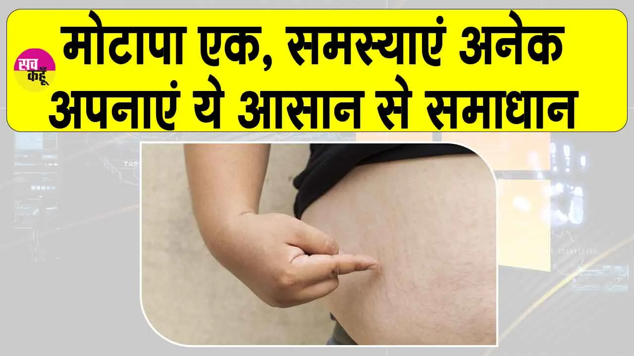 Obesity treatment in Ayurveda: मोटापा अनेक बीमारियों की जड़, कैसे काटें इसकी जड़?
