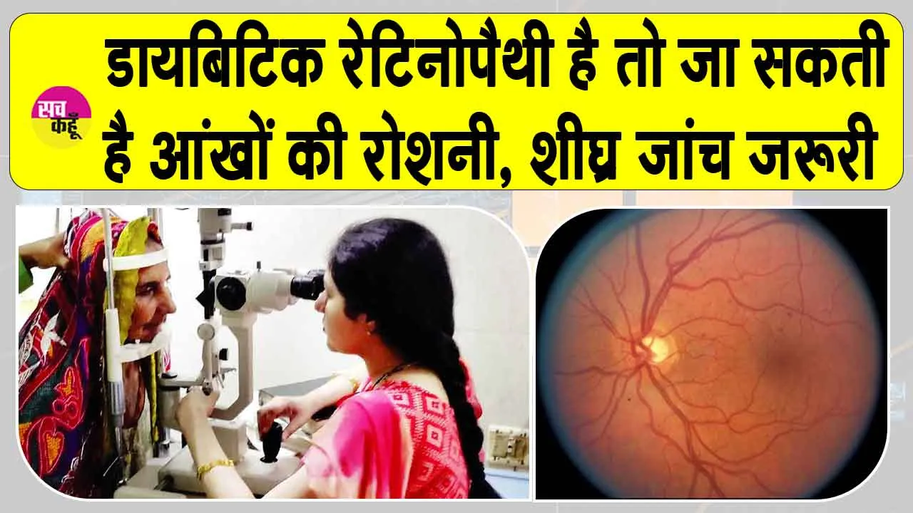 Diabetic Retinopathy: शुगर रोगियों को हो सकता है डायबिटिक रेटिनोपैथी, जिससे आंखों की रोशनी जानें का खतरा!