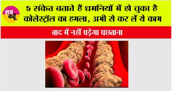 High Cholesterol Signs: 5 संकेत बताते हैं धमनियों में हो चुका है कोलेस्ट्रॉल का हमला, अभी से कर लें ये काम, नहीं तो पछताना पड़ेगा