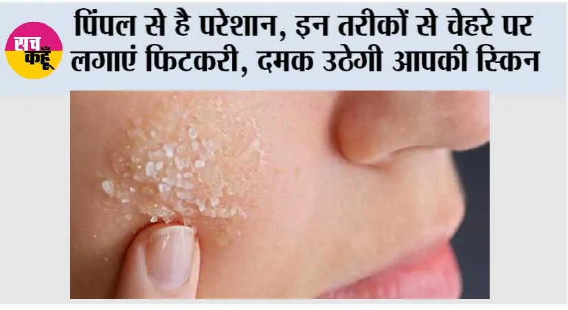 Benefits Of Alum On Skin: पिंपल से है परेशान, इन तरीकों से चेहरे पर लगाएं फिटकरी, दमक उठेगी आपकी स्किन