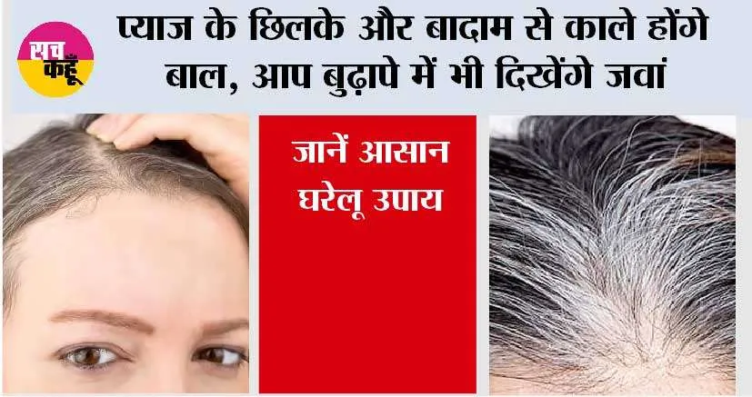 Hair Care Tips: प्याज के छिलके और बादाम से काले होंगे बाल, आप बुढ़ापे में भी दिखेंगे जवां, जानें आसान घरेलू उपाय