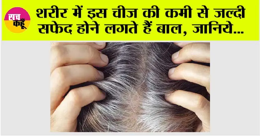 White Hair Problem: “बाल सफेद क्यों होते हैं? जाने क्या है विटामिन B-12 की अहमियत”