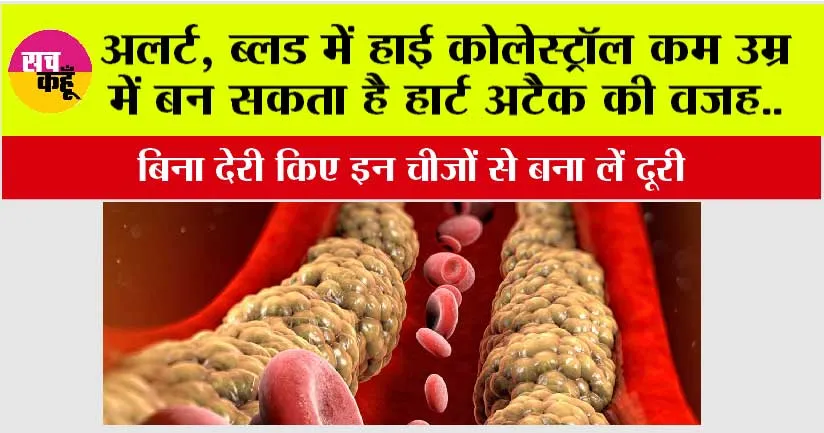 Cholesterol: ब्लड में हाई कोलेस्ट्रॉल कम उम्र में बन सकता है हार्ट अटैक की वजह, बिना देरी किए इन चीजों से बना लें दूरी