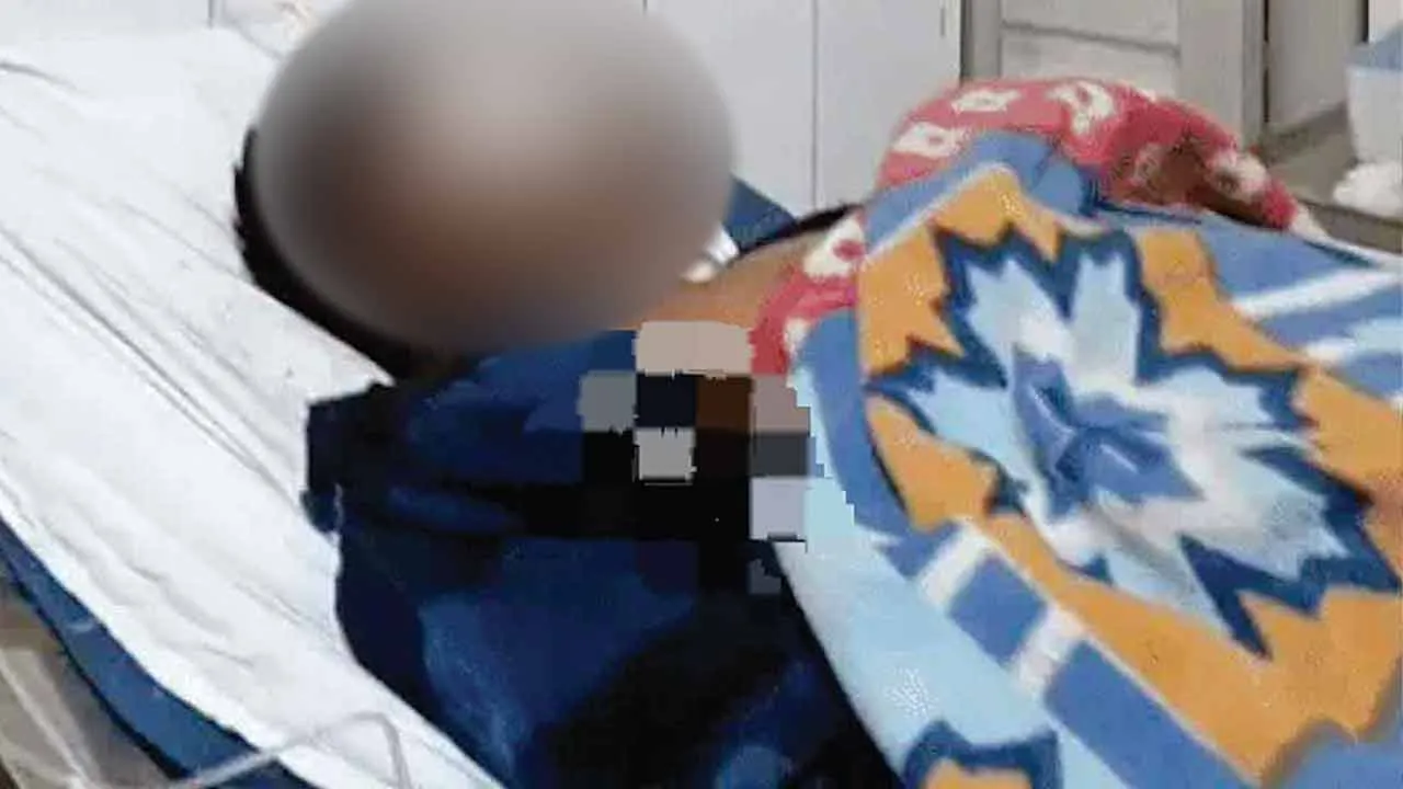 Gas Cylinder Leak: गैस सिलेंडर लीक होने से लगी आग, युवक झुलसा