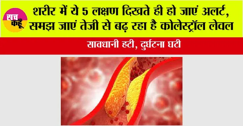 Signs of High Cholesterol: शरीर में ये 5 लक्षण दिखते ही हो जाएं अलर्ट, समझ जाएं तेजी से बढ़ रहा है कोलेस्ट्रॉल लेवल
