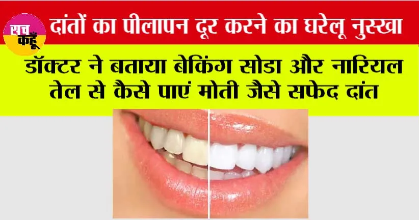 Dant Chamkane Ka Gharelu Upay: दांतों का पीलापन दूर करने का घरेलू नुस्खा: डॉक्टर ने बताया बेकिंग सोडा और नारियल तेल से कैसे पाएं मोती जैसे सफेद दांत