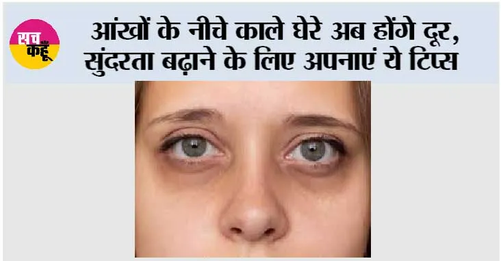 Dark Circle Tips: डार्क सर्कल होंगे गायब, चेहरा दिखेगा दमकता! सर्दियों में अपनाएं ये घरेलू नुस्खा…
