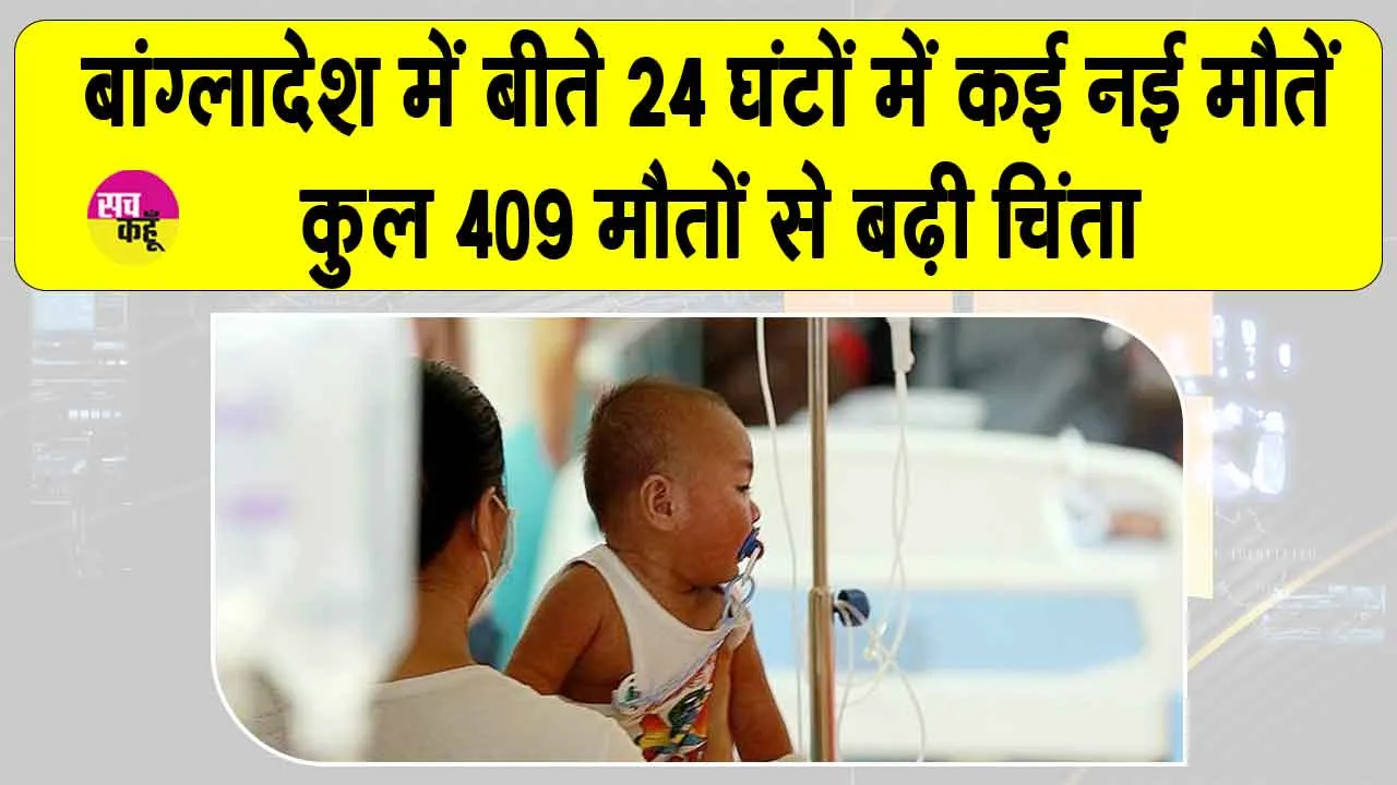 बांग्लादेश में खसरा गंभीर, कुल 409 मौतों से बढ़ी चिंता