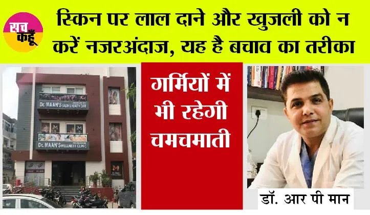 Skin Care Tips: बढ़ती गर्मी और बदलते मौसम से बढ़ रहे त्वचा रोग, बचाव के लिए सतर्क रहना जरूरी : डॉ. आर पी मान