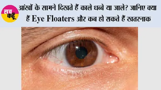 Eye Floaters Symptoms: आंखों के सामने दिखते हैं काले धब्बे या जाले? जानिए क्या हैं Eye Floaters और कब हो सकते हैं खतरनाक