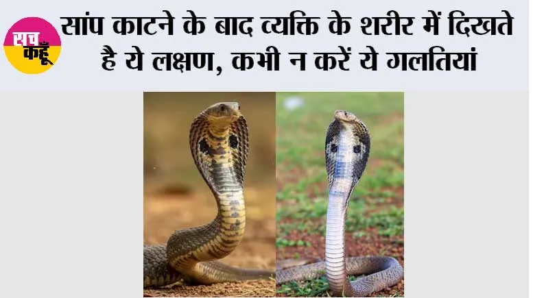 Snake News: सांप काटने के बाद भूलकर भी न करें ये गलतियां, समय पर सही इलाज बचा सकता है जान