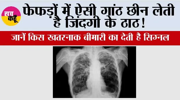 Symptoms of lung nodules: फेफड़ों में ऐसी गांठ छीन लेती है जिंदगी के ठाठ! जानें किस खतरनाक बीमारी का देती है सिग्नल 