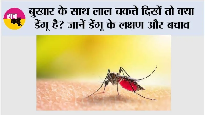 Dengue Symptoms: बुखार के साथ लाल चकत्ते दिखें तो क्या डेंगू है? जानें डेंगू के लक्षण और बचाव