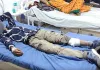 Rape Case: बांदा पुलिस ने मुठभेड़ के बाद रेप के दो आरोपियों को किया गिरफ्तार
