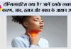 टॉन्सिलाइटिस क्या है? जानें इसके लक्षण, कारण, जांच, इलाज और बचाव के आसान उपाय