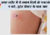 Dengue Symptoms: अगर शरीर में ये लक्षण दिखें तो नजरअंदाज न करे, तुरंत डॉक्टर के पास जाए