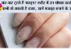 Nail Care Tips: बार-बार टूटते हैं नाखून? शरीर में इन पोषक तत्वों की कमी हो सकती है वजह, जानें मजबूत बनाने के उपाय