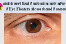 Eye Floaters Symptoms: आंखों के सामने दिखते हैं काले धब्बे या जाले? जानिए क्या हैं Eye Floaters और कब हो सकते हैं खतरनाक