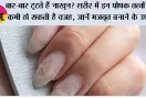 Nail Care Tips: बार-बार टूटते हैं नाखून? शरीर में इन पोषक तत्वों की कमी हो सकती है वजह, जानें मजबूत बनाने के उपाय