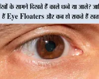 Eye Floaters Symptoms: आंखों के सामने दिखते हैं काले धब्बे या जाले? जानिए क्या हैं Eye Floaters और कब हो सकते हैं खतरनाक