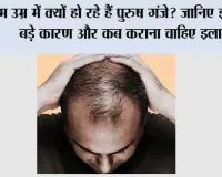 Hair Loss in Men: कम उम्र में क्यों हो रहे हैं पुरुष गंजे? जानिए इसके 5 बड़े कारण और कब कराना चाहिए इलाज