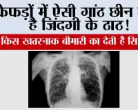 Symptoms of lung nodules: फेफड़ों में ऐसी गांठ छीन लेती है जिंदगी के ठाठ! जानें किस खतरनाक बीमारी का देती है सिग्नल 
