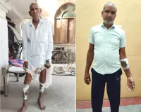 खेत में काम कर रहे किसान व मजदूर पर अज्ञात जानवर का हमला, दहशत