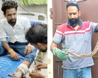 Farrukhabad Snakebite: युवक को सांप ने डसा तो जिंदा सांप लेकर अस्पताल पहुंचा दोस्त, अस्तपाल में हड़कंप