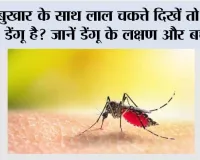 Dengue Symptoms: बुखार के साथ लाल चकत्ते दिखें तो क्या डेंगू है? जानें डेंगू के लक्षण और बचाव