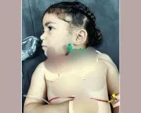 लूट के पीड़ित और 4 वर्षीय मासूम बच्ची पर लुटेरों ने किया जानलेवा हमला