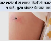 Dengue Symptoms: अगर शरीर में ये लक्षण दिखें तो नजरअंदाज न करे, तुरंत डॉक्टर के पास जाए