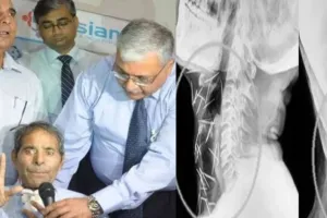 सर्जरी कर डॉक्टरों ने बद्रीलाल के गले से निकली  92 पिने