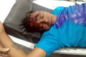 गंभीर घायल ने तोड़ा दम, हत्या की आशंका