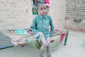 रोग ऐसा की नहीं पहने कपड़े